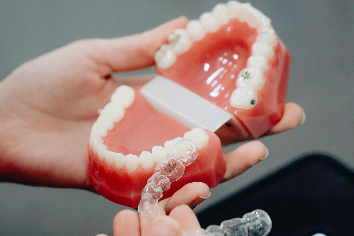 Clear aligner trays for discreet teeth straightening at Dental Dew Rohini